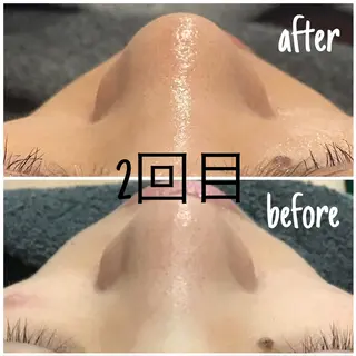 アルカンジュ~archange~所属・痩身/毛穴洗浄/脱毛 アルカンジュのエステ・リラクイメージ