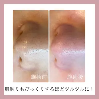 美肌脱毛&毛穴専門 Nico🐰ྀི♡のエステ・リラクイメージ