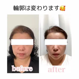 小顔と ヘッドスパのお店のエステ・リラクイメージ