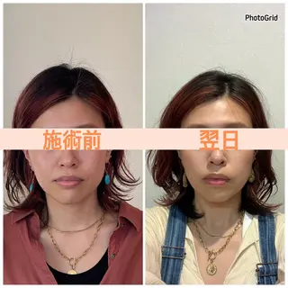 小顔矯正サロン　ReFace Fusae（リフェイスフサエ）所属・小顔矯正サロン リフェイスフサエのエステ・リラクイメージ