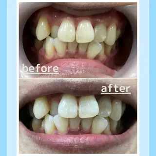 メンズ お手軽ホワイトニングsalon mina所属・武元 奈津美のその他イメージ