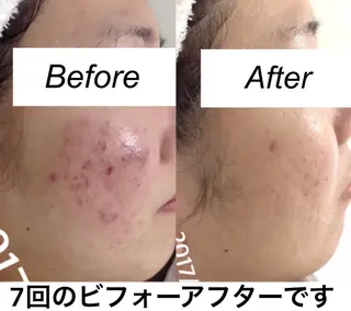 都度払い肌質改善 &脱毛Blancheのエステ・リラクイメージ