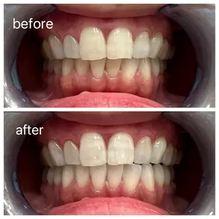 セルフホワイトニング Shineeのエステ・リラクイメージ