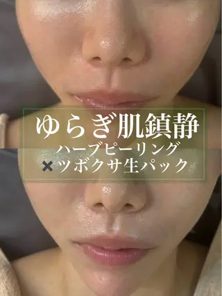 WHITE AQUA 北千住店のエステ・リラクイメージ