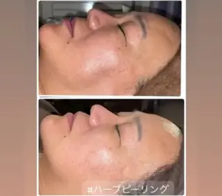 FLEUR フルール所属・FLEUR🫧 フェイシャルのエステ・リラクイメージ