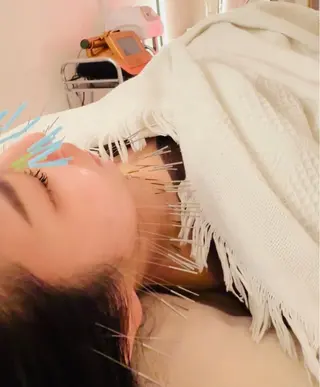 鍼灸サロン　MARINOTE所属・鍼灸サロン MARINOTEのエステ・リラクイメージ