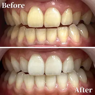 LBSホワイトニング 銀座店💎公式のその他イメージ