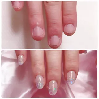 ネイル 深爪を断らない スカルプ高評価店のネイルデザイン