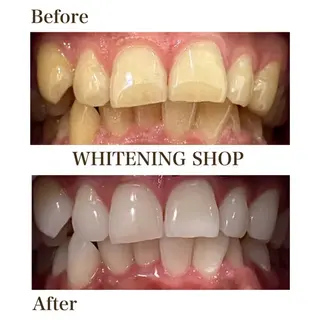 ホワイトニング ショップ川越店のエステ・リラクイメージ