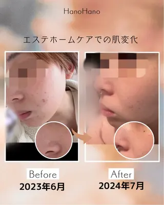 ナカツカ サエのエステ・リラクイメージ