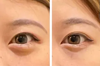 最速小顔・肌質管理 ❣️エスポワールのエステ・リラクイメージ