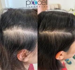 Blooming所属・LOUISE. ／肌質・頭皮のエステ・リラクイメージ