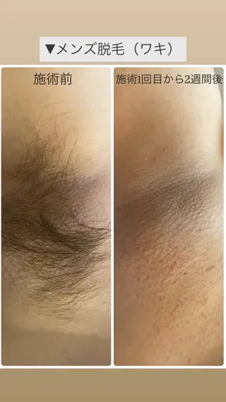 春日井/脱毛・エステサロン　salon de AZURE所属・salon de AZUREのその他イメージ