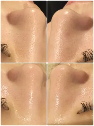 【リベルハーブピーリング認定店】敏感肌・美白脱毛専門店Dione立川店所属・Dione 立川店のエステ・リラクイメージ