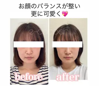 小顔と ヘッドスパのお店のエステ・リラクイメージ