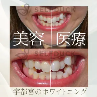 歯科提携セルフダック 宇都宮駒生店のエステ・リラクイメージ