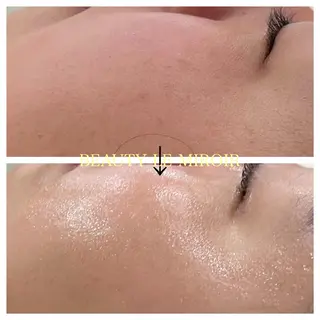 ビューティー ミロワールのエステ・リラクイメージ