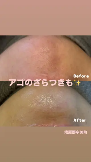 毛穴専門店 le e'rableのその他イメージ