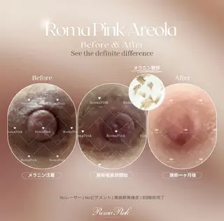 Eye Herb🌿 エステのエステ・リラクイメージ