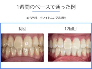 セルフホワイトニング エクシア岡崎店所属・ホワイトニング/脱毛 専門店エクシア岡崎店のその他イメージ
