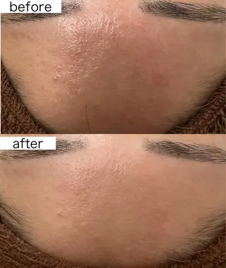 Beauty   Salon  Adiy所属・Adiy ikumiのエステ・リラクイメージ