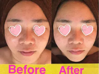 痩身リンパダイエット 隠れ家サロンチャームのエステ・リラクイメージ