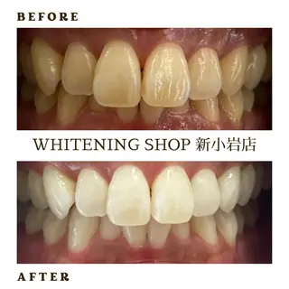 メンズ ホワイトニング ショップ新小岩店のその他イメージ