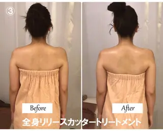 痩身×フェイシャル ブライダル|Linoのエステ・リラクイメージ