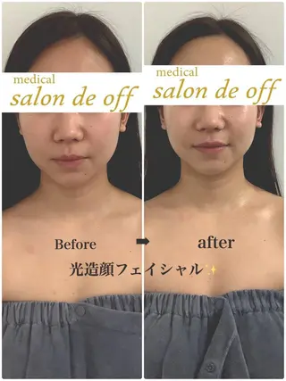 🩵Tatsumi Kana🩵のエステ・リラクイメージ