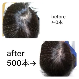 痛ネイル/ワンホン/ フィルイン/長さだしのネイルデザイン