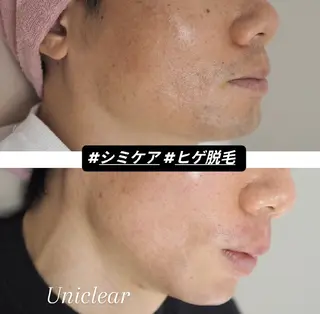 ユニセックスエステサロンUniclear所属・男女エステユニクリア Uniclearのエステ・リラクイメージ