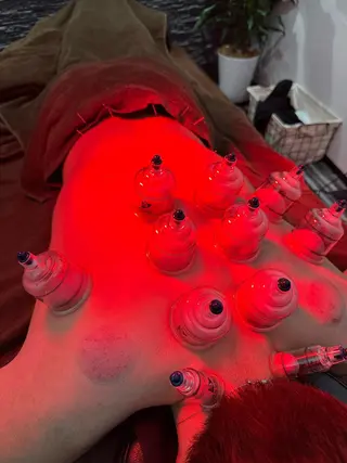 美容鍼灸整体サロンBeauJu所属・小顔矯/美容鍼/鍼灸 BeauJuのその他イメージ