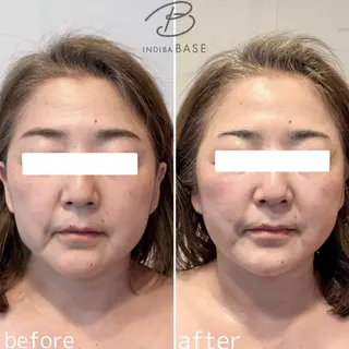 インディバベース あさみのエステ・リラクイメージ