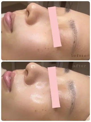 mihan beauteのエステ・リラクイメージ