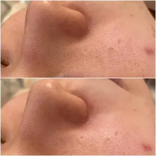 ✨美肌水光✨ アトリエリュバンのエステ・リラクイメージ