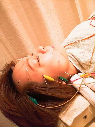 むくみたるみ専門☆ 美容鍼・小顔矯正のエステ・リラクイメージ