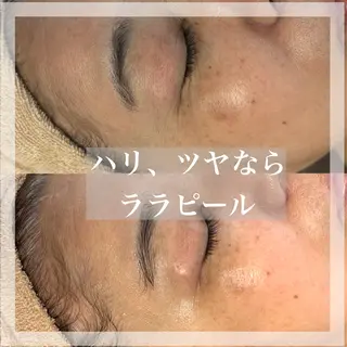 WHITE AQUA 北千住店のエステ・リラクイメージ