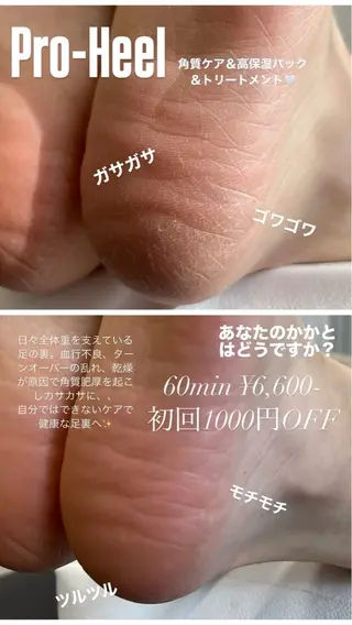 Tesoro.所属・プライベートサロン Tesoro.の眉毛・アイブロウイメージ