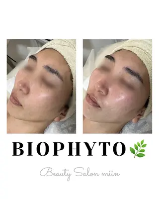 韓国肌管理 白玉肌管理®︎のエステ・リラクイメージ