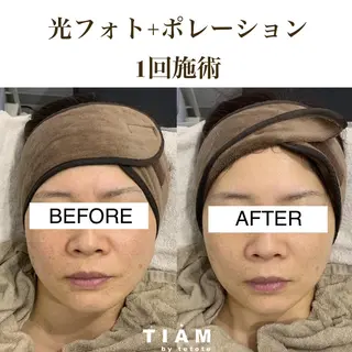 美肌サロンTIAM by tetoteのエステ・リラクイメージ