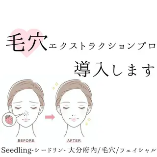 シードリン 府内店 小波のヘアスタイル