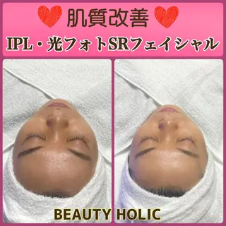 ニキビ・ 肌荒れ専門店のエステ・リラクイメージ