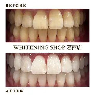 メンズ キッズ ホワイトニング ショップ葛西店のその他イメージ