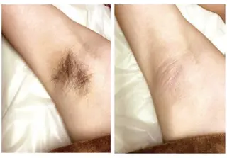 脱毛　Beauty salon Lumiere（ルミエール）所属・完全都度払い脱毛⭐︎ Lumiereのエステ・リラクイメージ