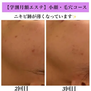 Bellesthe (ベルエステ)のエステ・リラクイメージ