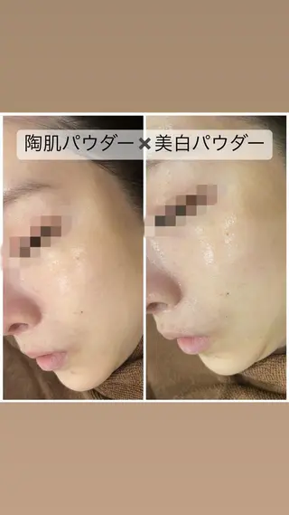 ミディアム カラー パーマ ヘアアレンジ メンズ キッズ ネイル マツエク・マツパ アイブロウ Amaryllis 🌹松本のエステ・リラクイメージ