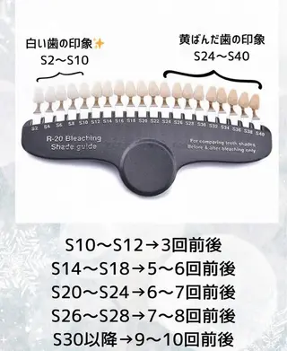 ホワイトニングショップ伊丹店所属・ホワイトニング ショップ伊丹店のその他イメージ