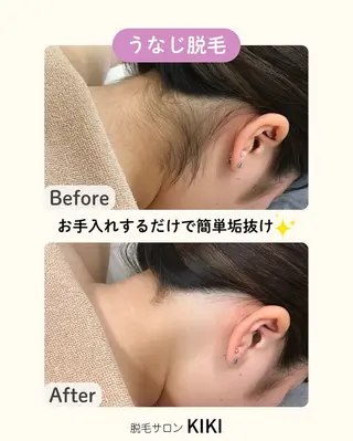 脱毛サロンKIKI所属・脱毛サロンKIKI みゆのエステ・リラクイメージ
