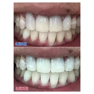 MBEAUTYSALON 千葉店・京成大久保所属・Melty 輝のその他イメージ