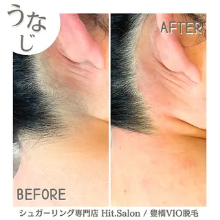 Hit. シュガーリング豊橋のエステ・リラクイメージ